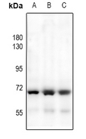 1 - Anti-HEXB Antibody AP60011