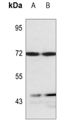 1 - Anti-LIMK1/2 Antibody AP60022