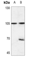 1 - Anti-EEF2K (pS366) Antibody AP60130