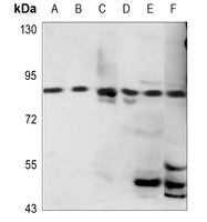 1 - Anti-HSD17B4 Antibody AP60180