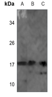 1 - Anti-NDUFB7 Antibody AP60193