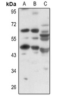 1 - Anti-OCTN1 Antibody AP60194
