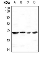 1 - Anti-GBA3 Antibody AP60292