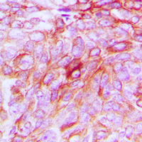 2 - Anti-Phospholipase D4 Antibody AP60360