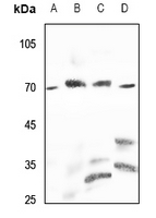 1 - Anti-PPP2R5D Antibody AP60366