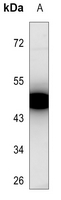 1 - Anti-PKA C gamma Antibody AP60367