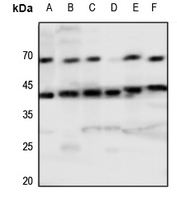 1 - Anti-Tachykinin Receptor 1 Antibody AP60400
