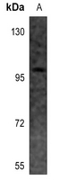 1 - Anti-EEF2K Antibody AP60452