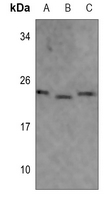 1 - Anti-MRPL40 Antibody AP60486