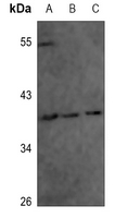 1 - Anti-Annexin A1 (pY21) Antibody AP60534