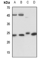 1 - Anti-RAB5C Antibody AP60687
