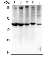 1 - Anti-MT-ND5 Antibody AP60708