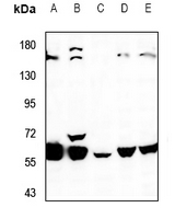 1 - Anti-K Cadherin Antibody AP60853