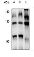 1 - Anti-RFC1 Antibody AP60861
