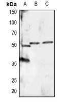 1 - Anti-RXR alpha (pS260) Antibody AP60933