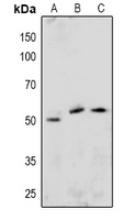 1 - Anti-ETS1 (pS251) Antibody AP60937