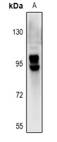 1 - Anti-OATP2 Antibody AP61003