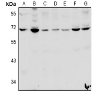 1 - Anti-HSPBAP1 Antibody AP61022