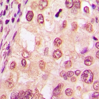 2 - Anti-Glucocorticoid Receptor (pS226) Antibody AP61063