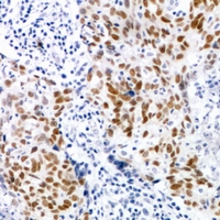 2 - Anti-CDK7 (pT170) Antibody AP61073