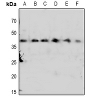 1 - Anti-CDK7 (pT170) Antibody AP61073