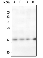 1 - Anti-Histone H2A (AcK95) Antibody AP61136