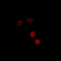 3 - Anti-Progesterone Receptor (pS400) Antibody AP61145