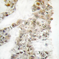 2 - Anti-DNA-PKcs (pS2056) Antibody AP61162