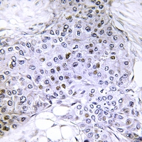 2 - Anti-Topoisomerase 2 alpha (pS1106) Antibody AP61172