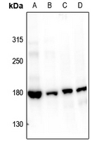 1 - Anti-Topoisomerase 2 alpha (pS1106) Antibody AP61172