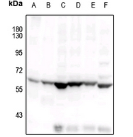 1 - Anti-COX1 Antibody AP61200
