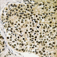 2 - Anti-NFAT3 (pS168/S170) Antibody AP61272