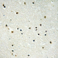 2 - Anti-CBX6 Antibody AP61301