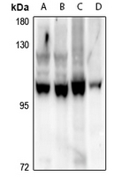 1 - Anti-HPK1 Antibody AP61314