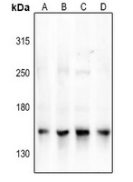 1 - Anti-NCOA3 Antibody AP61363