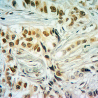 19 - Anti-Histone H2A (Butyryl-K5) Antibody AP61418