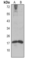 1 - Anti-Histone H2A (AcK9) Antibody AP61491