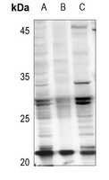 1 - Anti-RAB21 (AcK109) Antibody AP61505