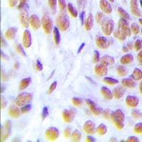 2 - Anti-Glucocorticoid Receptor Antibody AP61514