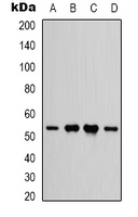 1 - Anti-IFNGR1 Antibody AP61528