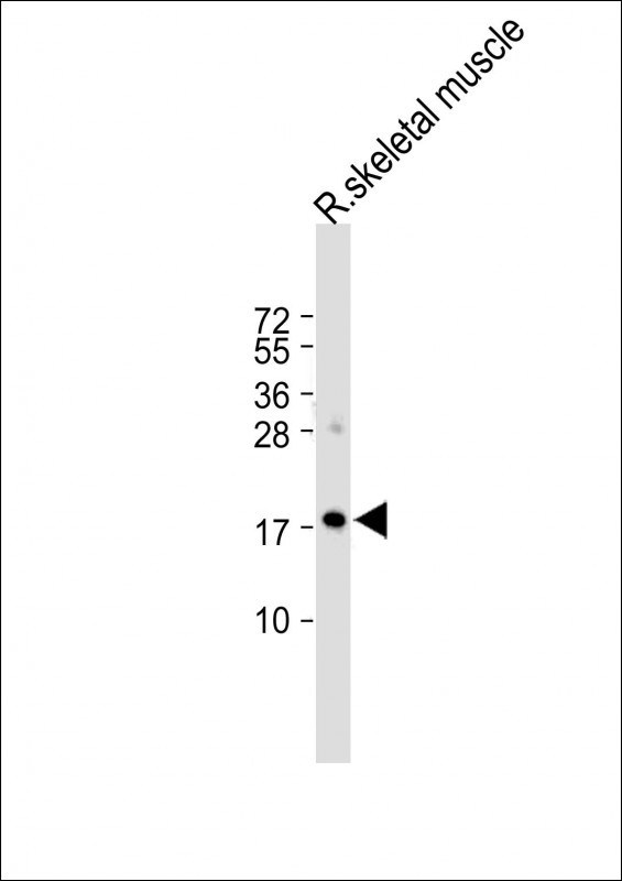 1 - ORMDL3 Antibody (Center) AP10739c