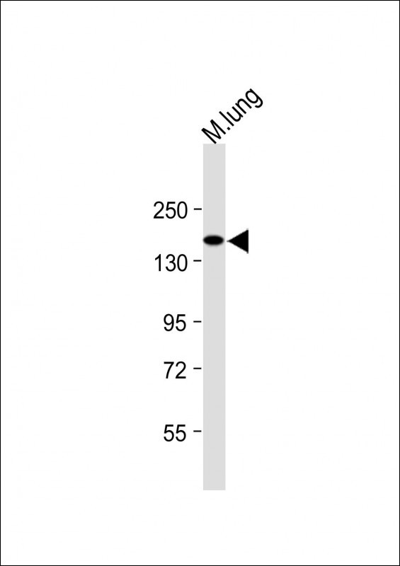 1 - XDH Antibody (N-term) AP9277A
