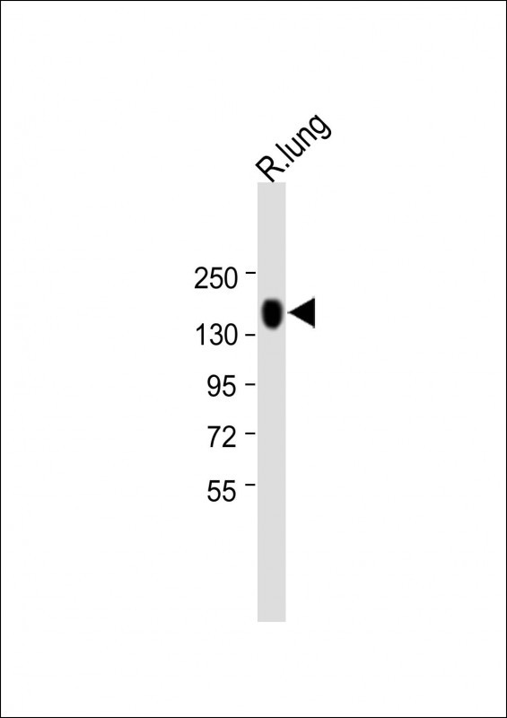 1 - XDH Antibody (N-term) AP9277A