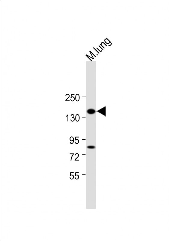 1 - XDH Antibody (N-term) AP9277A