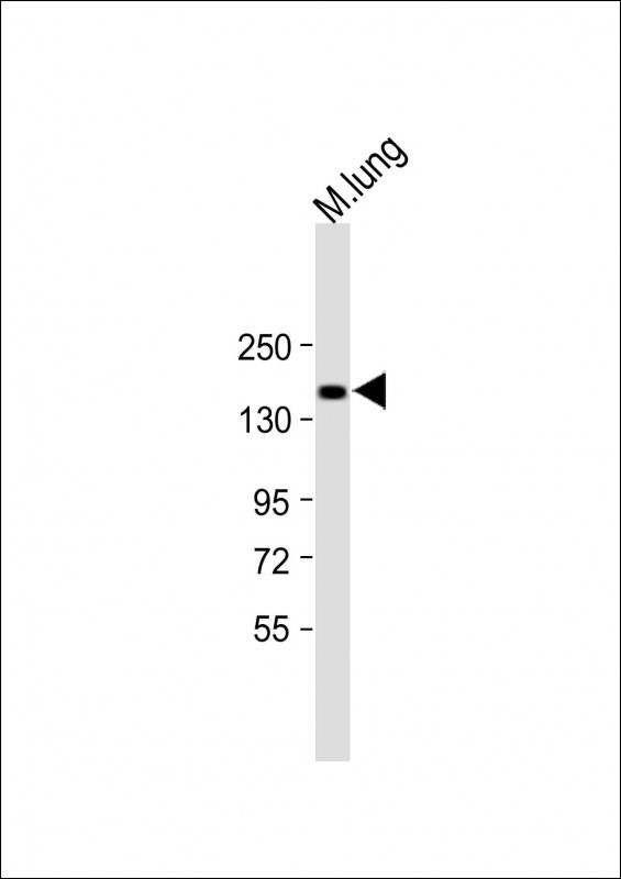 1 - XDH Antibody (N-term) AP9277A