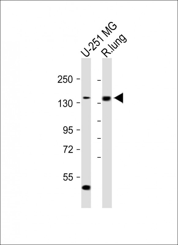 1 - XDH Antibody (N-term) AP9277A