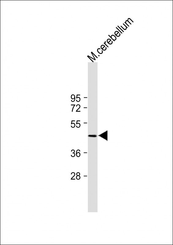 1 - SLC35F3 Antibody (Center) AP11376c