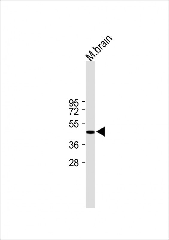 1 - FOXG1 Antibody (Center) AP9793C