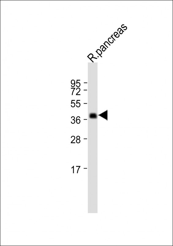 1 - SLC30A7 Antibody (N-term) AP12737a