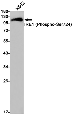1 - Phospho-IRE1 (Ser724) Rabbit pAb AP53594